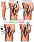 rodilla - hombro - cadera / knee - hip - shoulder
