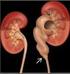 Diagnóstico pré-natal das anomalias do tracto urinário: dez anos de experiência