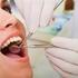 Abordagem odontológica de pacientes com risco de endocardite: um estudo de intervenção