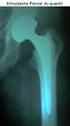 Avaliação dos resultados da artroplastia parcial de ombro para tratamento da artropatia por lesão do manguito rotador *