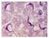 Detecção de Leishmania infantum em esfregaço de sangue periférico e linfonodo de um felino doméstico