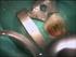 Anestesia em Odontopediatria, Pulpotomia e Pulpectomia