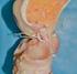 Relações anatômicas entre as inserções femorais dos ligamentos meniscofemoral de Wrisberg e cruzado posterior