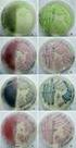 Isolation of Candida spp. using of the chromogenic culture medium CHROMagar Candida