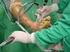 Tratamento artroscópico da síndrome do pinçamento subacromial, com e sem acromioplastia