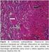 DETECÇÃO DE DNA DE MYCOBACTERIUM TUBERCULOSIS EM LÂMINAS DE BACILOSCOPIA