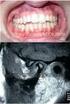 Inter-relação Ortodontia X Disfunção da Articulação Temporomandibular