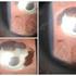 Análise da frequência de trauma ocular em pacientes de 0-10 anos no setor de plástica ocular do Hospital São Geraldo