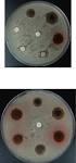Comparação da atividade antimicrobiana de extratos de confrei Symphytum officinale e agentes químicos