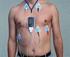 Eletrocardiograma de Longa Duração: o Sistema Holter Parte I