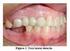 FIGURA 3 - FIGURA 4 - FIGURA 5 - Revista Dental Press de Ortodontia e Ortopedia Facial 1 5