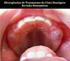 Divergências de Tratamento do Cisto Dentígero: Revisão Sistemática. Differences in the treatment of a dentigerous cyst: a systematic review