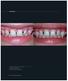 Caso Clínico. 114 Rev Dental Press Estét abr-jun;9(2):114-20