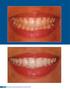 Clínica - International Journal of Brazilian Dentistry, Florianópolis, v.9, n.2, p , abr./jun. 2013