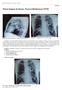 Imagem. Análise da imagem: Imagem 2: Radiografia do tórax, perfil esquerdo. Imagem 1: Radiografia do tórax, incidência posteroanterior.