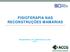 FISIOTERAPIA NAS RECONSTRUÇÕES MAMÁRIAS PALESTRANTE: FIT. ARETHUZZA ALVES 2018