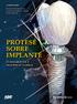 PRÓTESE SOBRE IMPLANTE