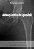 Artroplastia de quadril